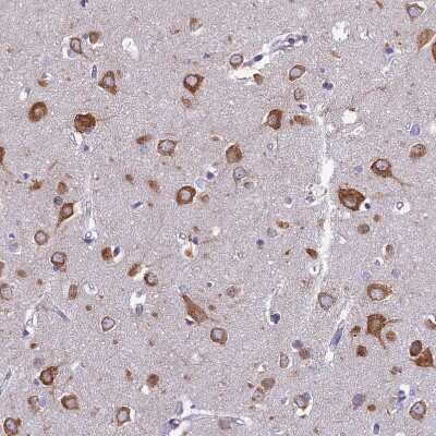 Immunohistochemistry-Paraffin: NALP12 Antibody [NBP1-85555]