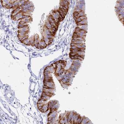 Immunohistochemistry-Paraffin: NALP12 Antibody [NBP1-85555]