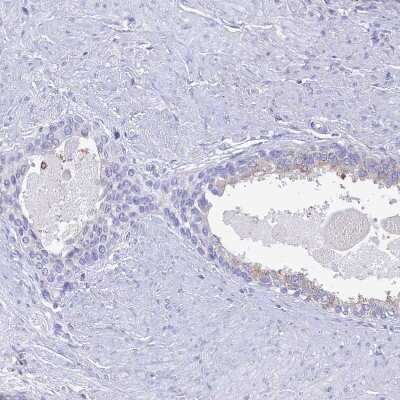 Immunohistochemistry-Paraffin: NALP12 Antibody [NBP1-85555]