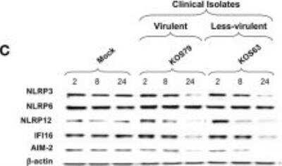 Western Blot: NALP12 AntibodyBSA Free [NBP1-76293]