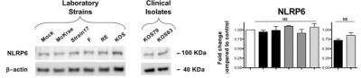Western Blot: NALP12 AntibodyBSA Free [NBP1-76293]