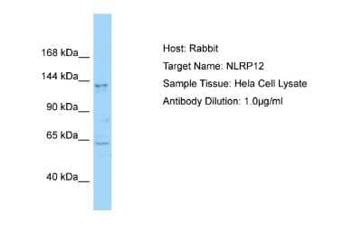 Western Blot: NALP12 Antibody [NBP2-87879]