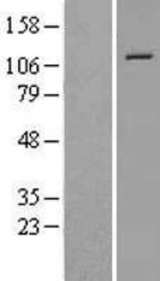 Western Blot: NALP12 Overexpression Lysate [NBL1-13673]