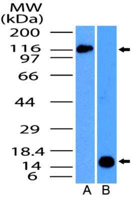 Western Blot: NALP4 Antibody [NBP2-31375]