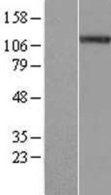 Western Blot: NALP4 Overexpression Lysate [NBP2-05685]