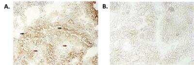 Immunohistochemistry: NALP6 Antibody (Clint-1) - BSA Free [NBP3-11675]