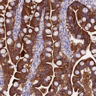 Immunohistochemistry: NALP6 Antibody [NBP2-47362]