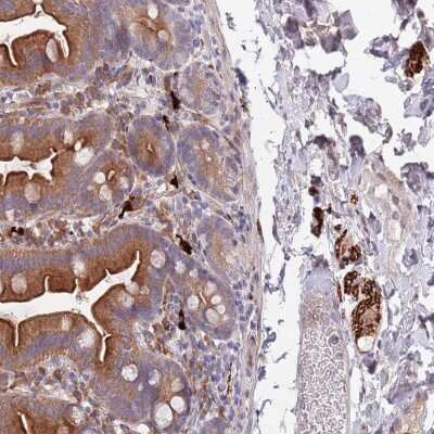 Immunohistochemistry: NALP6 Antibody [NBP2-48908]