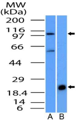 Western Blot: NALP6 Antibody [NBP2-31372]