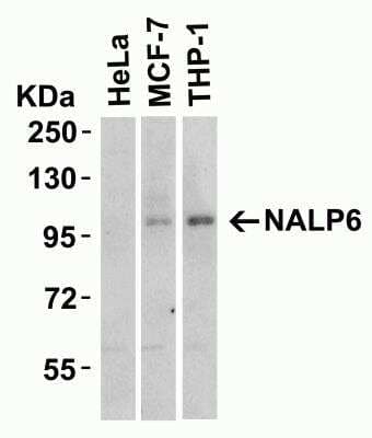 Western Blot: NALP6 AntibodyBSA Free [NBP2-81856]