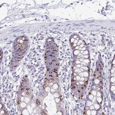 Immunohistochemistry-Paraffin: NALP8 Antibody [NBP2-33809]