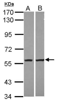 Western Blot: PBEF/Visfatin/NAMPT Antibody [NBP2-19468]