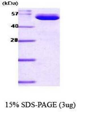 SDS-PAGE: Recombinant Mouse PBEF/Visfatin/NAMPT His Protein [NBC1-22597]