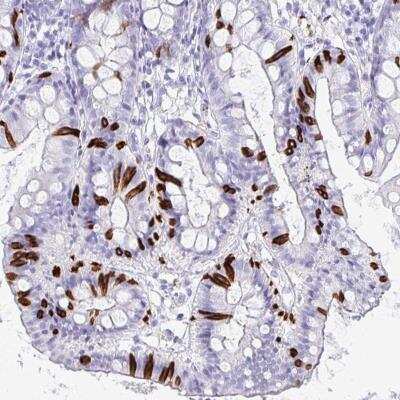 Immunohistochemistry-Paraffin: NANOGNB Antibody [NBP2-32538]