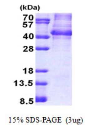 SDS-PAGE: Recombinant Human NANOGP8 His Protein [NBP2-23270]