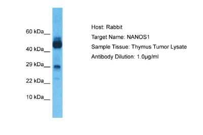 Western Blot: NANOS1 Antibody [NBP2-86720]