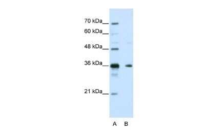 Western Blot: NANOS1 Antibody [NBP2-86721]