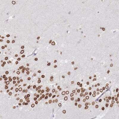 Immunohistochemistry-Paraffin: NANP Antibody [NBP2-13639]