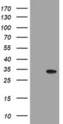 Western Blot: NANP Antibody (OTI4F5)Azide and BSA Free [NBP2-72874]