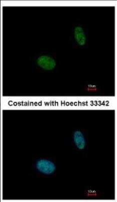 Immunocytochemistry/ Immunofluorescence: NANS Antibody [NBP2-19470]