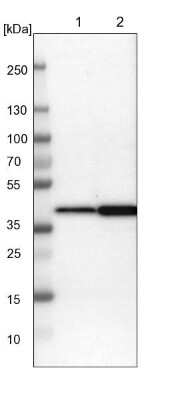 Western Blot: NANS Antibody [NBP1-87088]