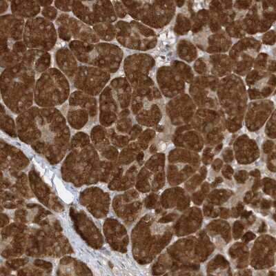 Immunohistochemistry-Paraffin: NAP1 Antibody [NBP2-33985]