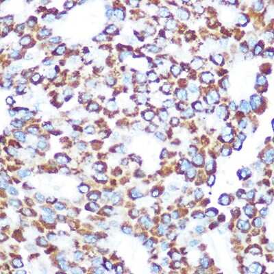 Immunohistochemistry-Paraffin: NAP1 Antibody - Azide and BSA Free [NBP3-15592]
