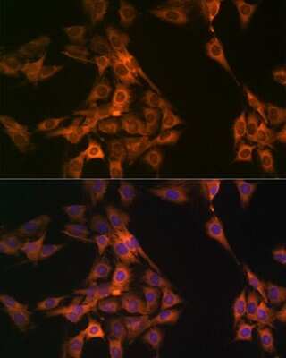 Immunocytochemistry/ Immunofluorescence: NAP1L1 Antibody (4W8B6) [NBP3-16633]