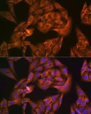 Immunocytochemistry/ Immunofluorescence: NAP1L1 Antibody (4W8B6) [NBP3-16633]