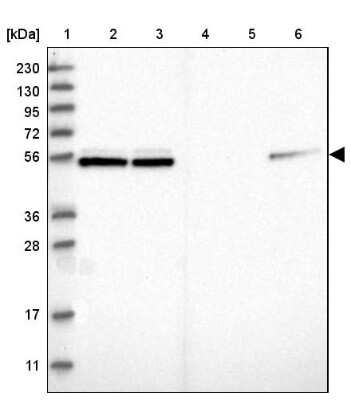 Western Blot: NAP1L1 Antibody [NBP1-81162]