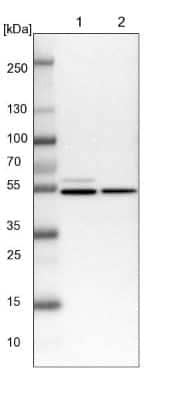 Western Blot: NAP1L1 Antibody [NBP1-81162]