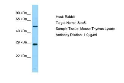 Western Blot: NAP1L1 Antibody [NBP2-87880]