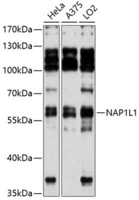 Western Blot: NAP1L1 AntibodyAzide and BSA Free [NBP2-94443]