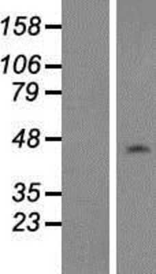 Western Blot: NAP1L1 Overexpression Lysate [NBP2-09975]