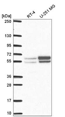 Western Blot: NAP1L2 Antibody [NBP2-58252]