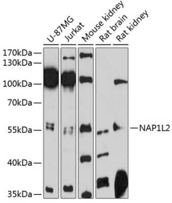 Western Blot: NAP1L2 AntibodyAzide and BSA Free [NBP2-93764]