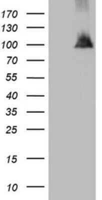 Western Blot: NAP1L3 Antibody (OTI3G3) [NBP2-46089]