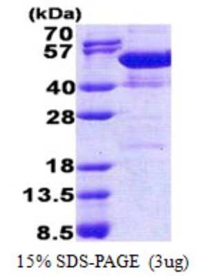 SDS-PAGE: Recombinant Human NAP1L4 His Protein [NBP2-23302]