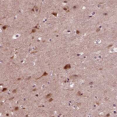 Immunohistochemistry-Paraffin: NAP1L5 Antibody [NBP2-55379]