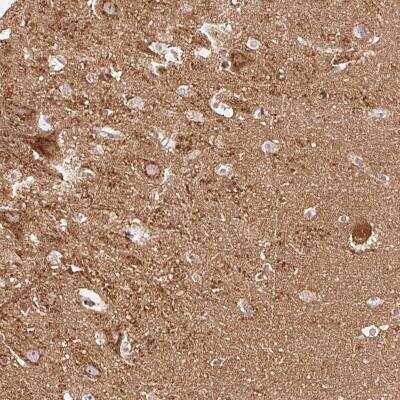 Immunohistochemistry: NAPA Antibody [NBP2-33457]