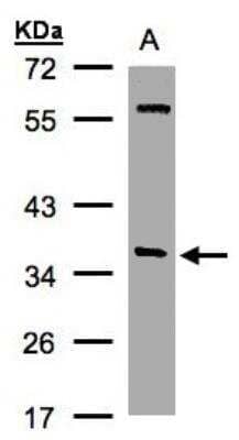 Western Blot: NAPA Antibody [NBP1-32493]