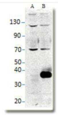 Western Blot: NAPA Antibody [NBP2-12752]