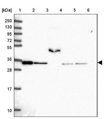 Western Blot: NAPA Antibody [NBP2-33593]