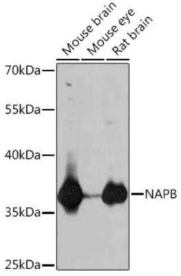 Western Blot: NAPB AntibodyAzide and BSA Free [NBP2-94485]