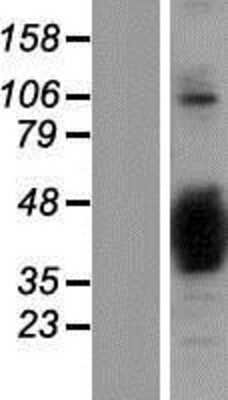 Western Blot: NAPB Overexpression Lysate [NBP2-06477]