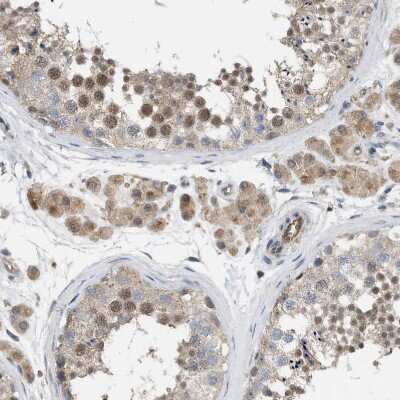 Immunohistochemistry-Paraffin: NAPE-PLD Antibody [NBP1-88248]