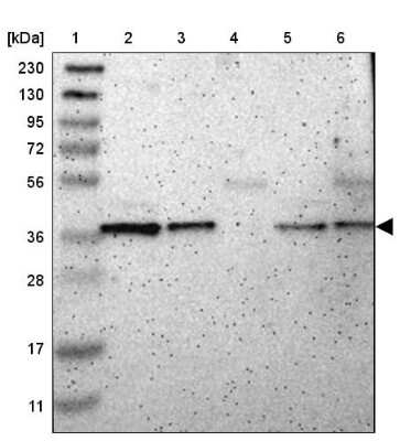 Western Blot: NAPG Antibody [NBP1-86101]