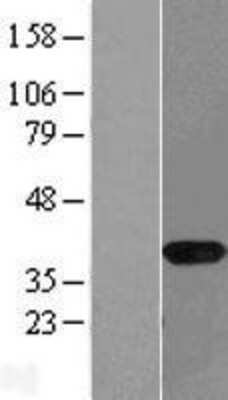 Western Blot: NAPG Overexpression Lysate [NBL1-13477]