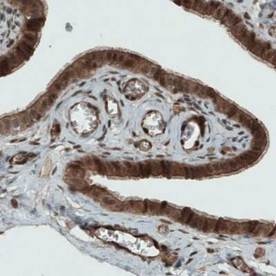 Immunohistochemistry-Paraffin: NAPRT1 Antibody (CL0366) [NBP2-52924]