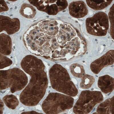 Immunohistochemistry-Paraffin: NAPRT1 Antibody (CL0366) [NBP2-52924]